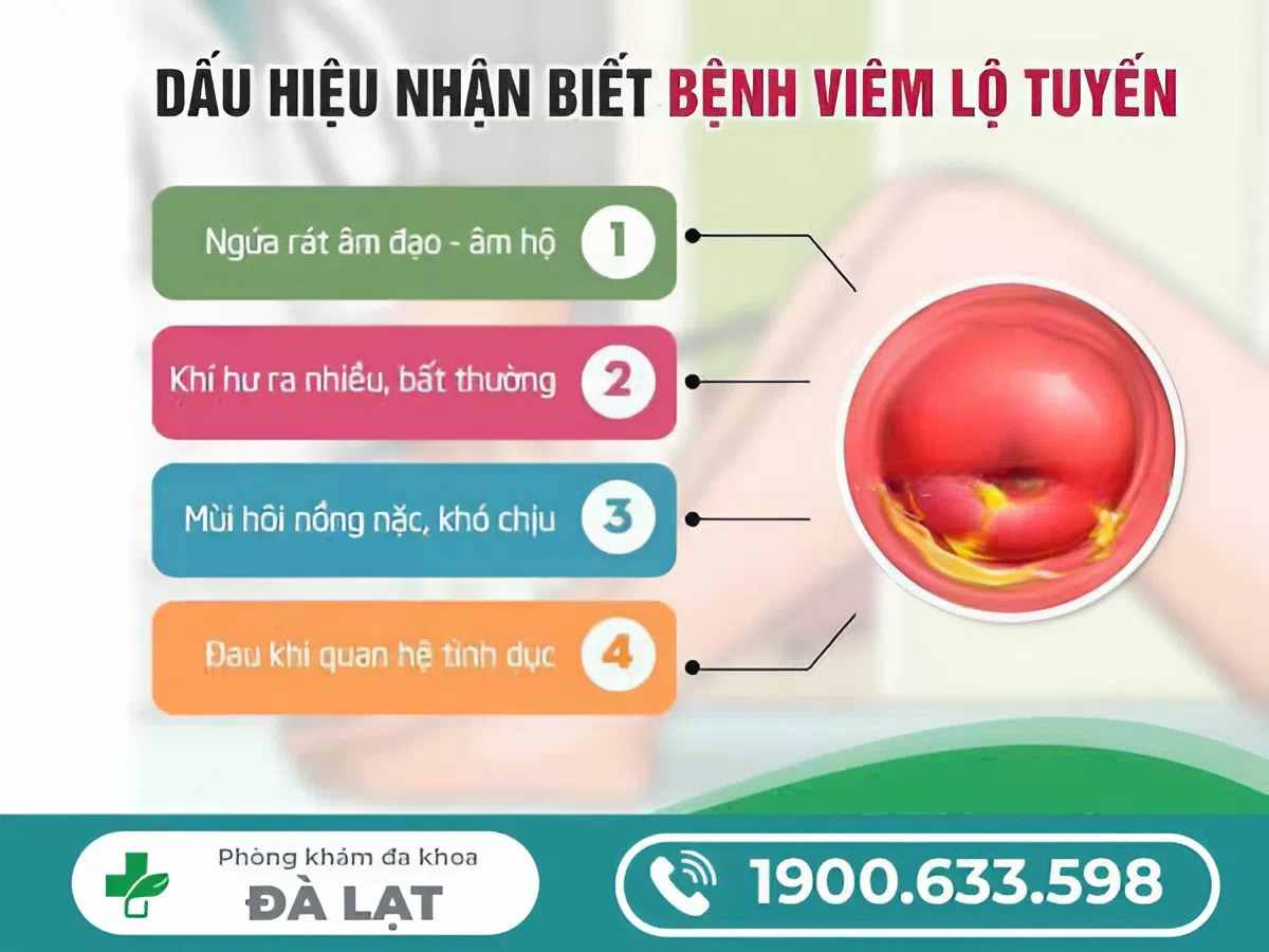 Hình ảnh minh họa